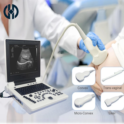 Color Doppler Ultrasound