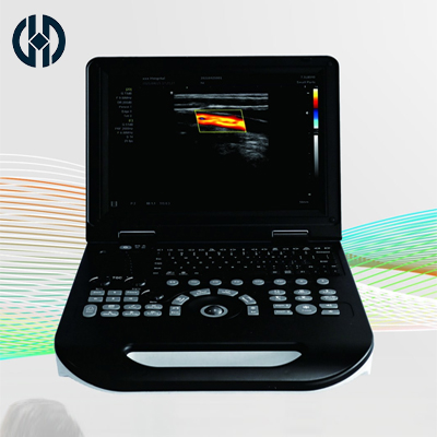 Color Doppler Ultrasound
